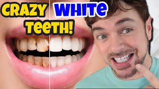 These whitening strips DISSOLVE on your teeth [upl. by Downall80]