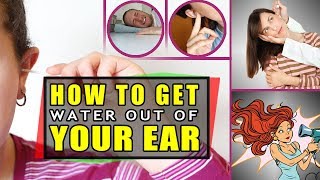 Swimmers ear  How to get water out of your ear  Swimmers ear treatment [upl. by Alidus66]