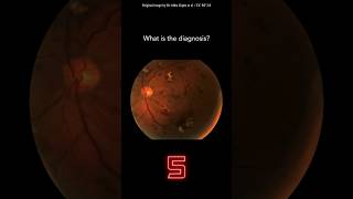 Fundoscopy Question 13 [upl. by Kerns]