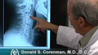 How to Read Xrays of the Cervical Spine Neck  Colorado Spine Expert [upl. by Siuqcram]