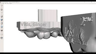 Embossing Text Patient Information on Dental Models [upl. by Elisa425]