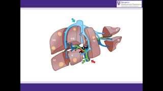 ALPPS procedure animation  A surgical solution for initially unresectable liver tumours [upl. by Cedell406]