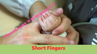 Brachydactyly  Baby Had Short Fingers Mother Wanted it to Be Genetic [upl. by Hyatt]