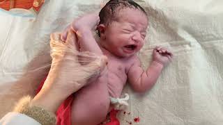 Breech delivery of beautiful newborn baby viral baby [upl. by Euqina]