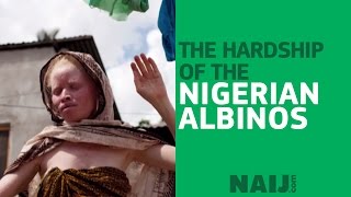 The hardship of Nigerian albinos  Legit TV [upl. by Aicital]