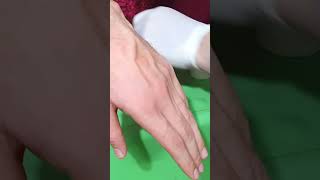 How to Insert IV Cannula  IV Cannulation Technique  Branula  Intravenous Catheter [upl. by Wehttam]