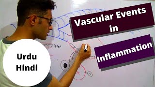 Vascular events of acute inflammation  increased vascular permeability  Urdu Hindi [upl. by Norraj212]