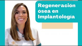 Resolvemos tus dudas sobre regeneración ósea dental [upl. by Flynn]