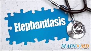 Elephantiasis ¦ Treatment and Symptoms [upl. by Bunting]