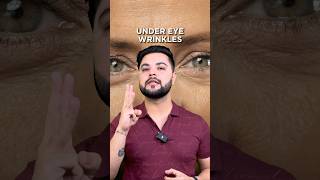 7 Days Skin Challenge Dark Circles Puffy Eye amp Undereye Wrinkles Treatment [upl. by Hasan]