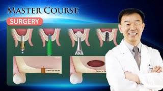 Master Course  SURGERY CAS Technique [upl. by Darda]