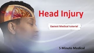 Head Injury  Extradural heamtoma Subdural hematoma [upl. by Lertnom752]