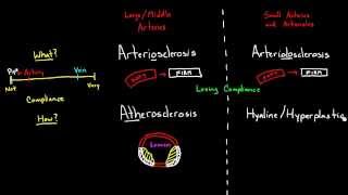 Arteriosclerosis Arteriolosclerosis and Atherosclerosis [upl. by Philbert]