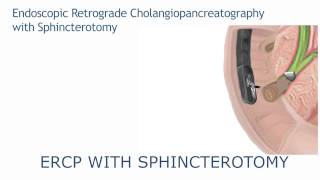 ERCP with sphincterotomy [upl. by Chabot885]