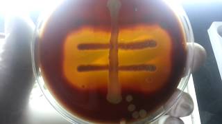 hemodigestion of blood agar Hemolysis differences [upl. by Catlee754]