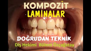 Kompozit Lamina 132 Doğrudan Teknik [upl. by Naras142]