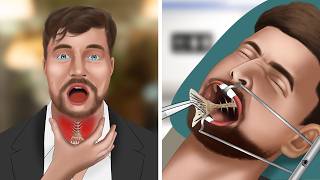 ASMR Animation Remove fish bones stuck in MrBeasts throat [upl. by Vincenty]