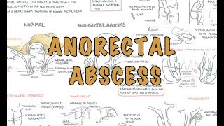 Anorectal Abscess General Surgery  Overview [upl. by Ahsirtal322]