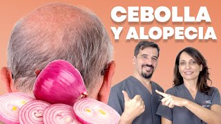 🔴 Cómo Preparar y Utilizar CEBOLLA para el Cabello 🧅 [upl. by Ran608]