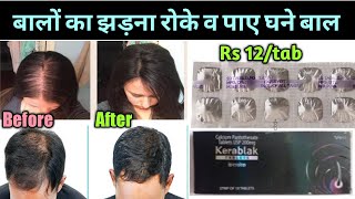 Kerablak Tablet reviewबालों का झड़ना रोके और पाएं घने और मजबूत बाल।। [upl. by Assylla]