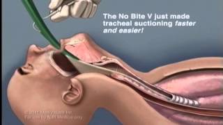 Tracheal Suction Nasotracheal Suction Suctioning Procedure Nasopharyngeal Suctioning NoBite V [upl. by Aehtrod681]