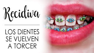 ¿SE VUELVEN A TORCER LOS DIENTES  RECIDIVA EN ORTODONCIA [upl. by Charley]