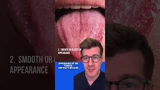 Signs of IRON DEFICIENCY ANAEMIA in the TONGUE  Glossitis explained shorts health anaemia [upl. by Darom]