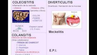 AA INFLAMATORIOavi [upl. by Milissa]