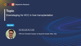 Downstaging for HCC in liver transplantation [upl. by Sinoda]