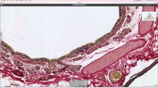 Histology of the lung [upl. by Names331]