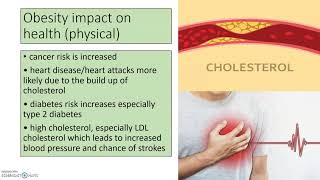 Obesity and Somatotypes GCSE PE [upl. by Eiralam498]