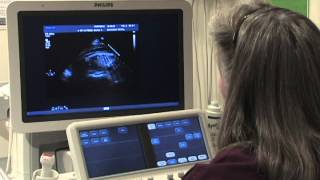 What Is a Fetal Echochardiogram Test [upl. by Akyeluz]