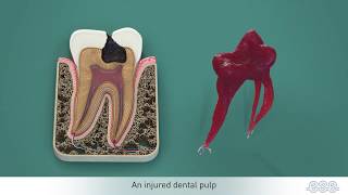 Endodontic treatments [upl. by Ahsaeyt279]