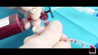 Platelet Rich Plasma PRP Automatic System CPUnT [upl. by Valentijn]