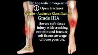 Orthopaedic Emergencies Part 3  Everything You Need To Know  Dr Nabil Ebraheim [upl. by Kurtzig]