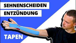 Sehnenscheidenentzündung tapen  Handgelenk tapen  Kinesiologie ANLEITUNG [upl. by Lananna439]