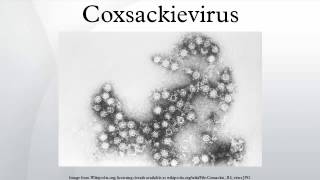 Coxsackievirus [upl. by Shaddock]