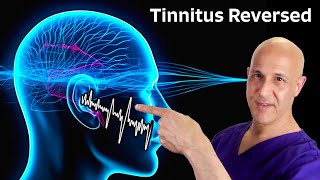 Tinnitus Reversed The Miracle of 1 Nutrient Dr Mandell [upl. by Rengaw]