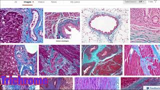 Histology stains such as eosin and hemotoxylin masons trichrome osmium tetroxide and more [upl. by Monica]