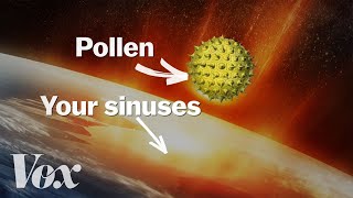 Why your allergies get worse every year [upl. by Assili69]