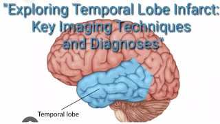 quotExploring Temporal Lobe Radiology Key Imaging Techniques and Diagnosesquot [upl. by Flory42]