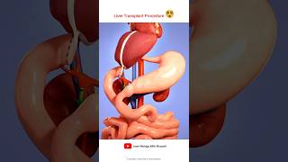 Liver transplant Procedure Animation Video [upl. by Garwin]