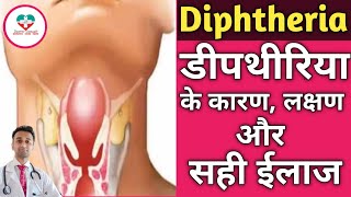 Diphtheria  डीपथेरिया किस वजह से होता है इसका ईलाज क्या है [upl. by Aysahc]