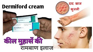 Dermiford cream full review benifitside effects amp usehindi [upl. by Eeslek]