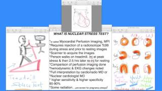 Mayo Clinic Minute What is a cardiac stress test [upl. by Aninaj]