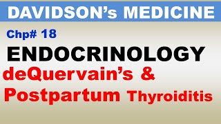 Davidsons Medicine Chp18Part9  deQuervains Thyroiditis  Postpartum Thyroiditis  Endocrinology [upl. by Norga]