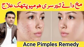 Acne Pimples Treatment in Pashto Language  wrinkles freckles remedy in pashto language  pukhto [upl. by Yeslrahc]