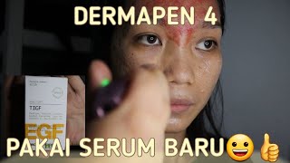 DERMAPEN 4  SERUM BARU INI BANYAK DIPAKAI OLEH KLINIK TERNAMA  BOPENG MEMBAIK [upl. by Mauceri]