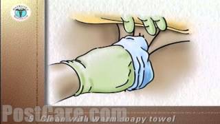 Discharge Perineal Vaginal Wash Female Patient Education Medical Video [upl. by Janelle]