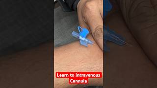 Learn to intravenous cannula  कैनुला लगाना सीखे सीखे shorts new trending SMpharmacy [upl. by Sumahs]